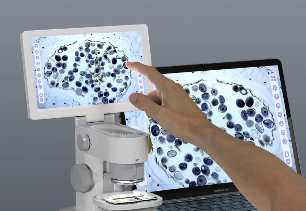 best digital coin microscope